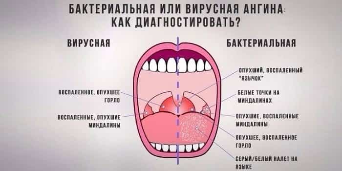 фибрилляция предсердий